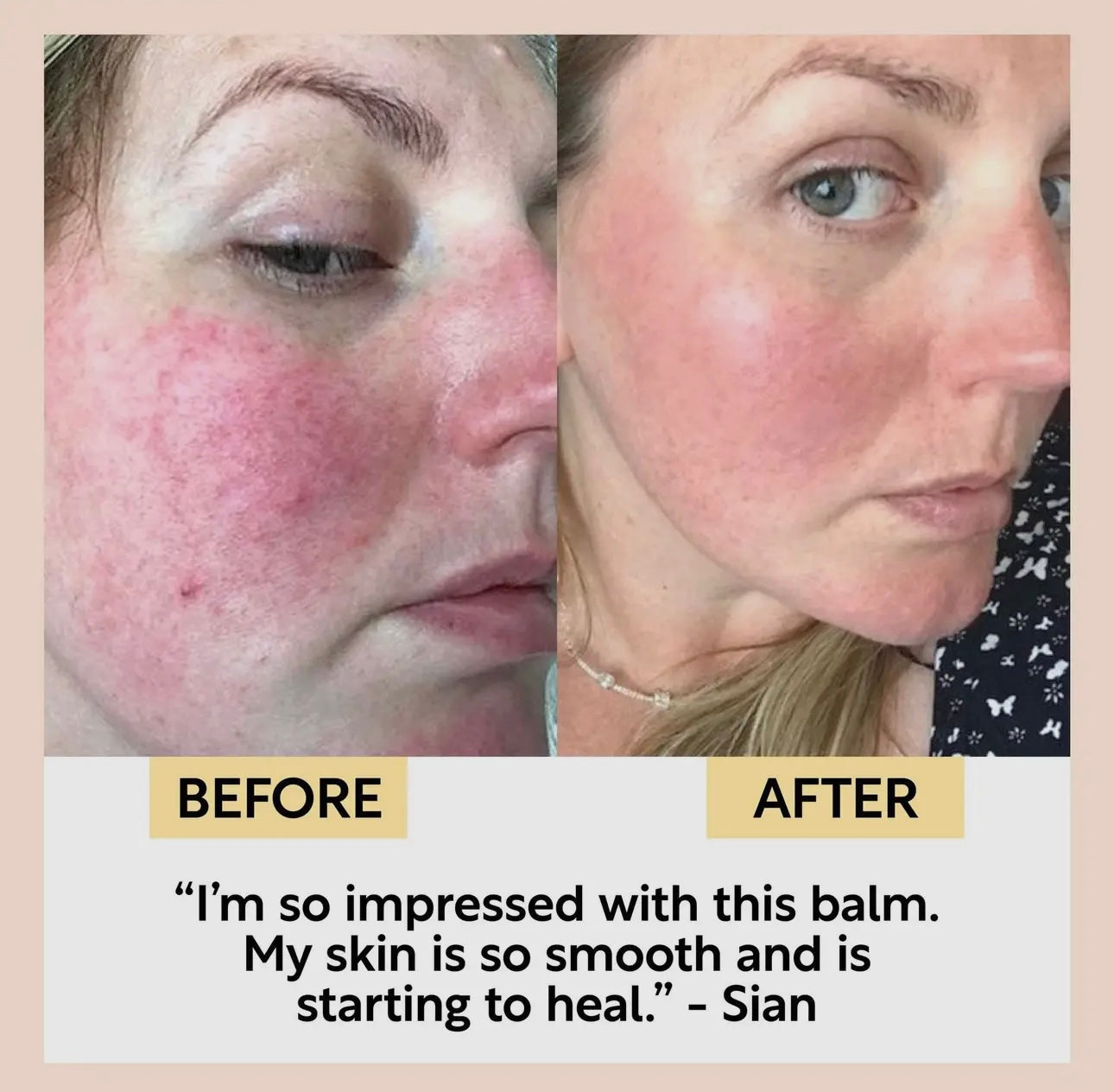 UpCircle Cleansing Face Balm