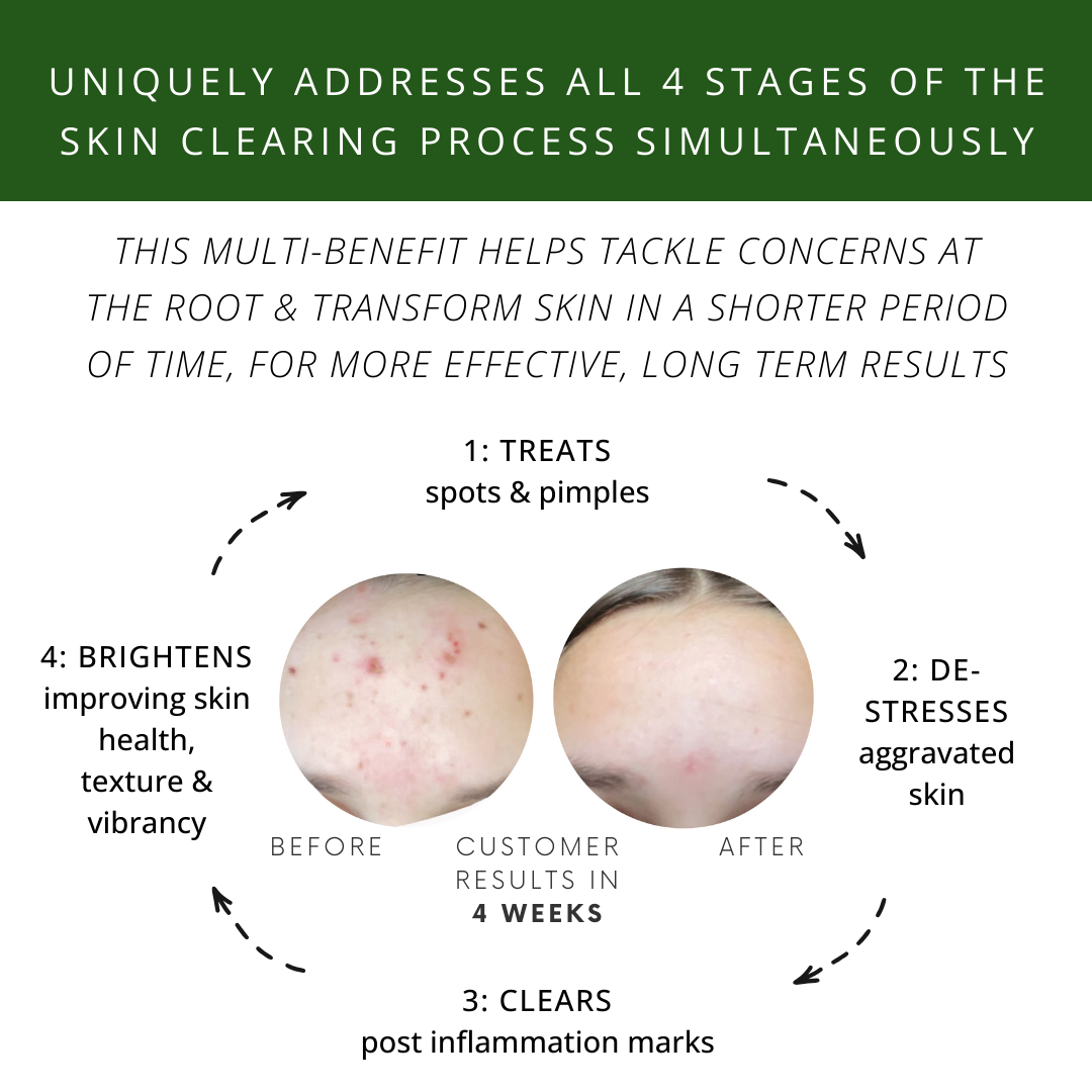 Frank's Remedies - Sun Drops Facial Serum - Beauty and the Benefit